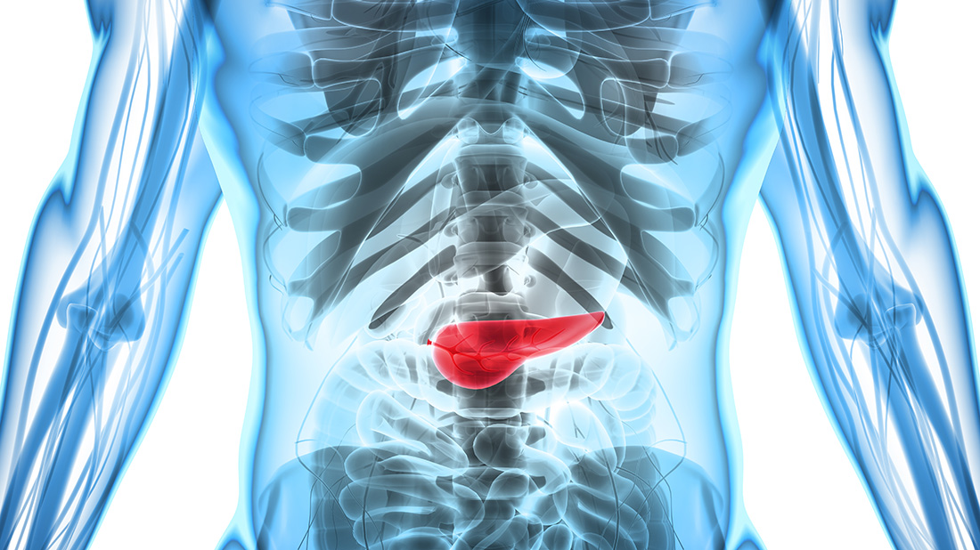 render of pancreatic cancer